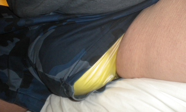 <p>Super wet swollen diaper and plastic pants showing through the leg of my shorts.</p>