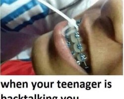 Braces, they can be so much fun for a lot of reasons.